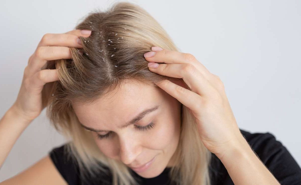 Forfora, l’unico metodo funzionante per evitare l’EFFETTO NEVE | Lavarli 2 volte al giorno non serve a niente