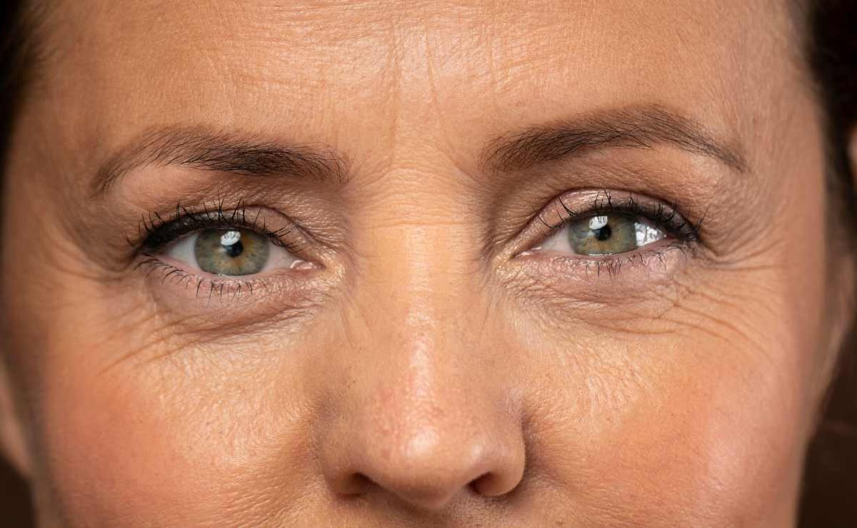 Il dottore mi ha detto che ho queste occhiaie “da orco” perchè mangio malissimo | Questi cibi sono assolutamente proibiti